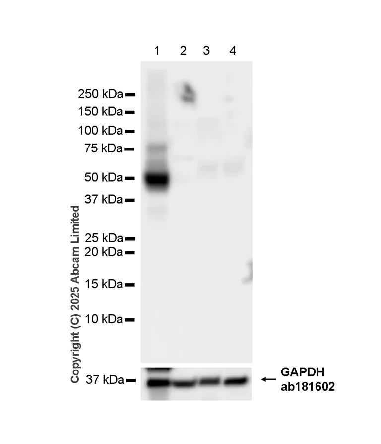 Western blot - Anti-ATP1B2 antibody [EPR15461(B)] - C-terminal (AB185207)