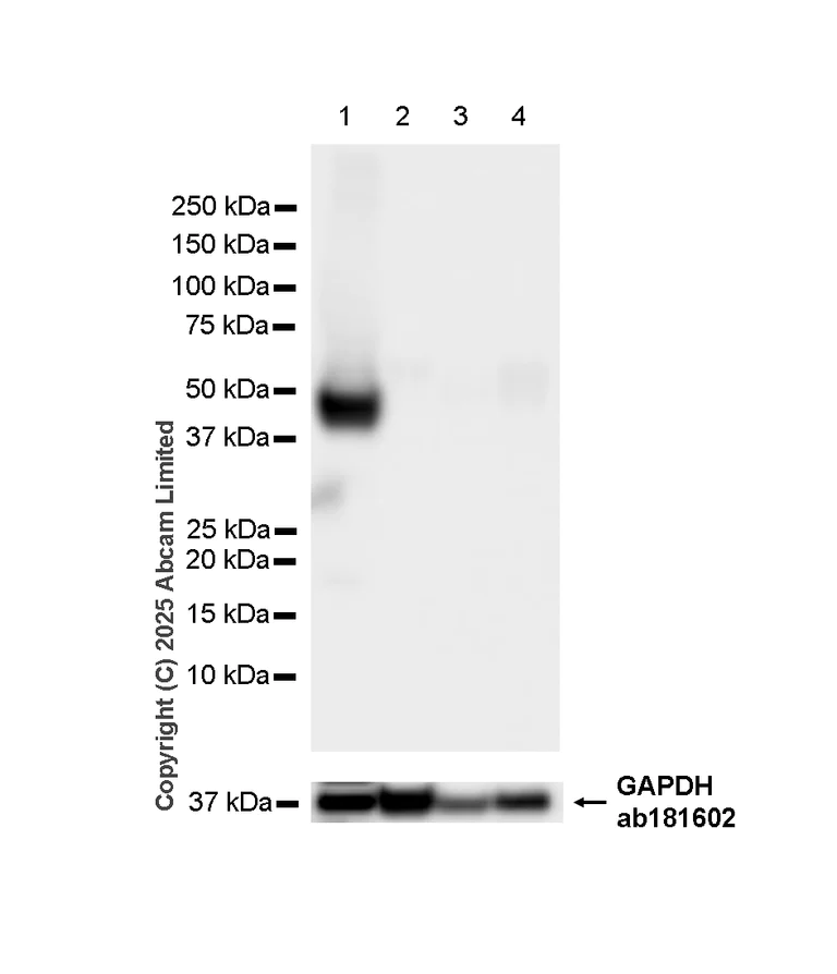 Western blot - Anti-ATP1B2 antibody [EPR15461(B)] - C-terminal (AB185207)
