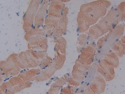 Immunohistochemistry (Formalin/PFA-fixed paraffin-embedded sections) - Anti-ATP1B3 antibody (AB231671)