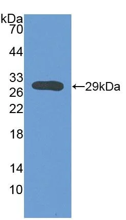 Western blot - Anti-ATP1B3 antibody (AB231671)