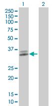 Western blot - Anti-ATP1B3 antibody (AB67409)