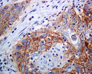 Immunohistochemistry (Formalin/PFA-fixed paraffin-embedded sections) - Anti-ATP1B3 antibody [EPR8981] (AB137055)