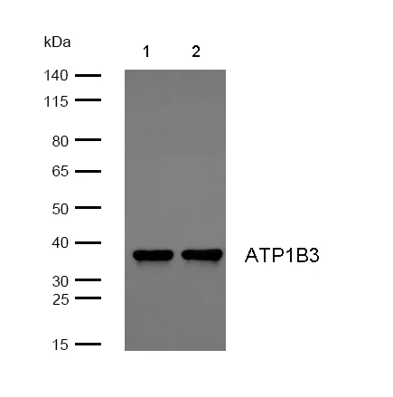 Western blot - Anti-ATP1B3 antibody [SR4028] (AB326700)