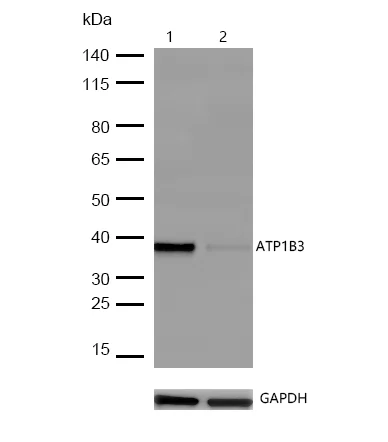 Western blot - Anti-ATP1B3 antibody [SR4028] (AB326700)