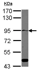 Western blot - Anti-ATP2C1 antibody (AB126171)