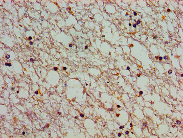 Immunohistochemistry (Formalin/PFA-fixed paraffin-embedded sections) - Anti-ATP2C1 antibody (AB238487)