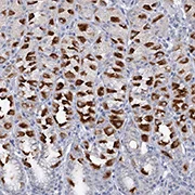 Immunohistochemistry (Formalin/PFA-fixed paraffin-embedded sections) - Anti-ATP4A antibody (AB122537)