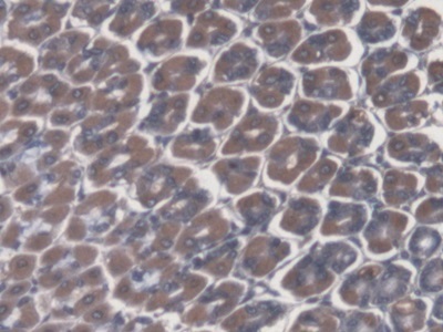 Immunohistochemistry (Formalin/PFA-fixed paraffin-embedded sections) - Anti-ATP4A antibody (AB231729)