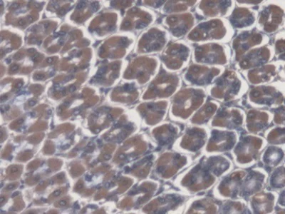 Immunohistochemistry (Formalin/PFA-fixed paraffin-embedded sections) - Anti-ATP4A antibody (AB231729)