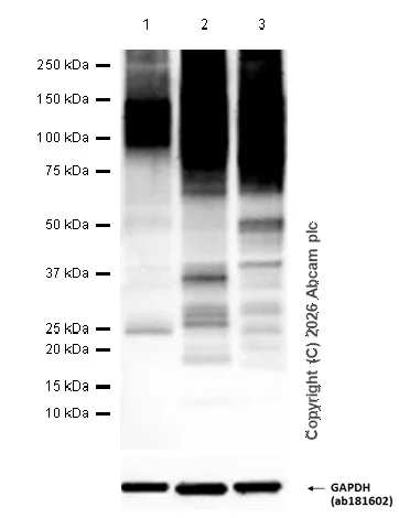 Western blot - Anti-ATP4A antibody [EPR12251] (AB174293)