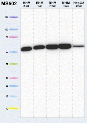 Western blot - Anti-ATP5A antibody [7H10BD4F9] - Mitochondrial Marker (AB110273), expandable thumbnail