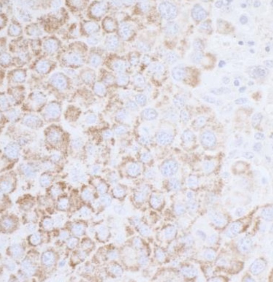 Immunohistochemistry (Formalin/PFA-fixed paraffin-embedded sections) - Anti-ATP5A antibody (AB245580), expandable thumbnail