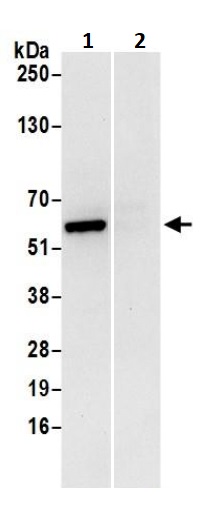 Immunoprecipitation - Anti-ATP5A antibody (AB245580), expandable thumbnail