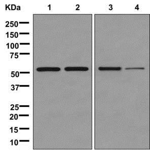 Western blot - Anti-ATP5A antibody [EPR13030(B)] - Mitochondrial Marker (ab176569), expandable thumbnail