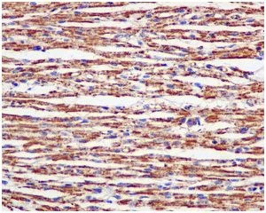 Immunohistochemistry (Formalin/PFA-fixed paraffin-embedded sections) - Anti-ATP5A antibody [EPR13031] - BSA and Azide free (AB250045)