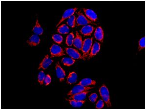 Immunocytochemistry/ Immunofluorescence - Anti-ATP5A antibody [EPR13031] (AB178421), expandable thumbnail