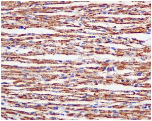 Immunohistochemistry (Formalin/PFA-fixed paraffin-embedded sections) - Anti-ATP5A antibody [EPR13031] (AB178421), expandable thumbnail