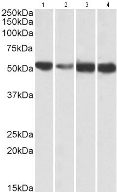 Western blot - Anti-ATP5A antibody - Mitochondrial Marker (AB188107), expandable thumbnail