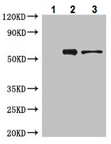 Immunoprecipitation - Anti-ATP5A antibody - Mitochondrial Marker (AB222887), expandable thumbnail
