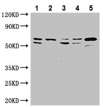 Western blot - Anti-ATP5A antibody - Mitochondrial Marker (AB222887), expandable thumbnail