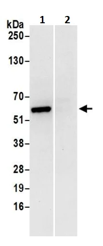 Immunoprecipitation - Anti-ATP5A antibody - Mitochondrial Marker (AB245580)