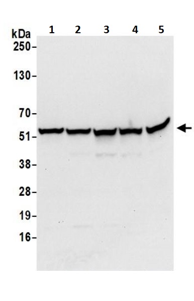 Western blot - Anti-ATP5A antibody - Mitochondrial Marker (AB245580), expandable thumbnail