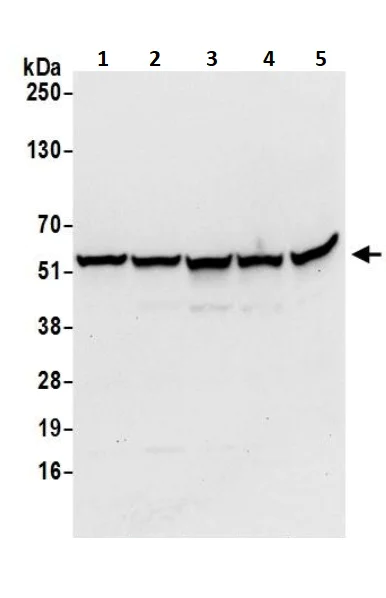 Western blot - Anti-ATP5A antibody - Mitochondrial Marker (AB245580)