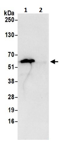 Immunoprecipitation - Anti-ATP5A antibody - Mitochondrial Marker (AB245581), expandable thumbnail