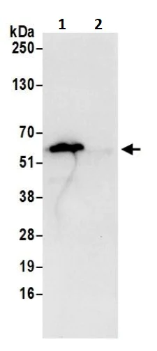 Immunoprecipitation - Anti-ATP5A antibody - Mitochondrial Marker (AB245581)