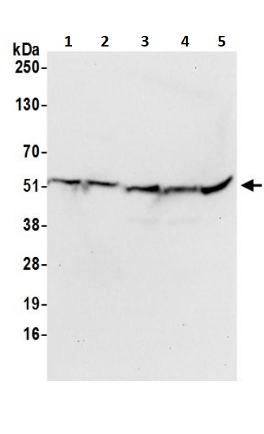 Western blot - Anti-ATP5A antibody - Mitochondrial Marker (AB245581), expandable thumbnail