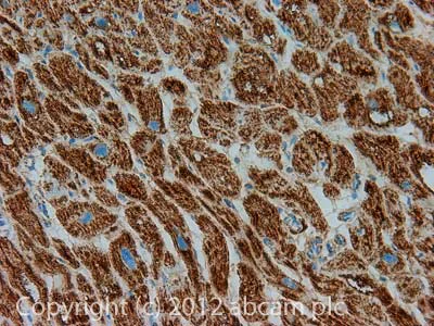 Immunohistochemistry (Formalin/PFA-fixed paraffin-embedded sections) - Anti-ATP5C1 antibody [2A1AA11] (AB119686)
