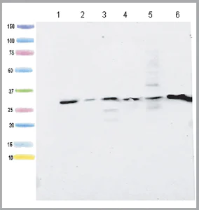 Western blot - Anti-ATP5C1 antibody [2A1AA11] (AB119686)