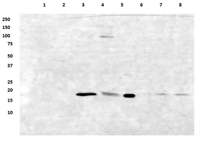 Western blot - Anti-ATP5D antibody [4D11] (AB174438)