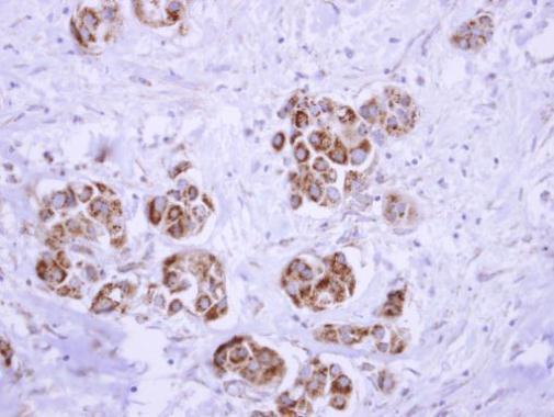 Immunohistochemistry (Formalin/PFA-fixed paraffin-embedded sections) - Anti-ATP5D antibody (AB97491)