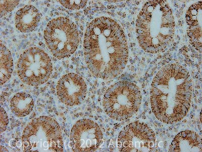 Immunohistochemistry (Formalin/PFA-fixed paraffin-embedded sections) - Anti-ATP5F1 antibody [9D1BC4] (AB117991), expandable thumbnail