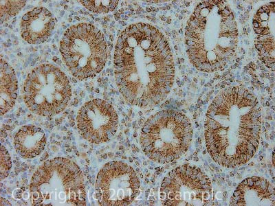 Immunohistochemistry (Formalin/PFA-fixed paraffin-embedded sections) - Anti-ATP5F1 antibody [9D1BC4] (AB117991)