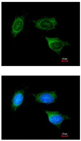 Immunocytochemistry/ Immunofluorescence - Anti-ATP5F1 antibody (AB154564)