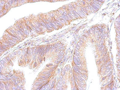 Immunohistochemistry (Formalin/PFA-fixed paraffin-embedded sections) - Anti-ATP5F1 antibody (AB154564)