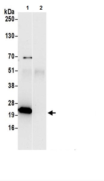 Immunoprecipitation - Anti-ATP5F1 antibody (AB217054), expandable thumbnail