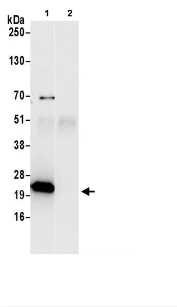 Immunoprecipitation - Anti-ATP5F1 antibody (AB217054)