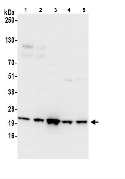 Western blot - Anti-ATP5F1 antibody (AB217054), expandable thumbnail