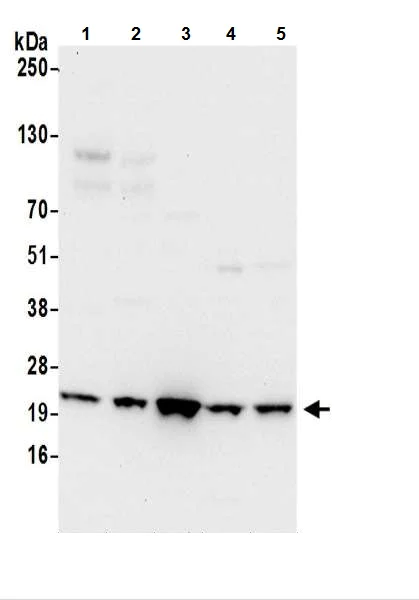 Western blot - Anti-ATP5F1 antibody (AB217054)