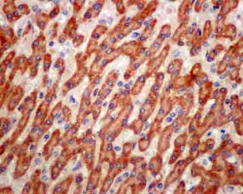 Immunohistochemistry (Formalin/PFA-fixed paraffin-embedded sections) - Anti-ATP5G1/G2/G3 antibody [EPR13908] (ab180149), expandable thumbnail