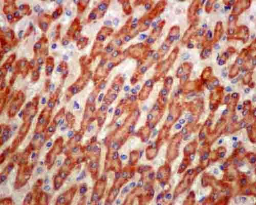 Immunohistochemistry (Formalin/PFA-fixed paraffin-embedded sections) - Anti-ATP5G1/G2/G3 antibody [EPR13908] (AB180149)