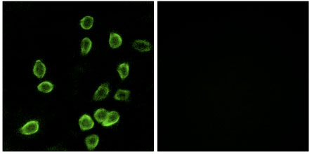Immunocytochemistry/ Immunofluorescence - Anti-ATP5G3 antibody (AB129742)