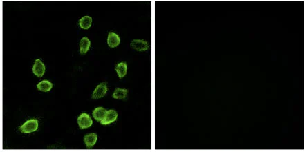 Immunocytochemistry/ Immunofluorescence - Anti-ATP5G3 antibody (AB129742)