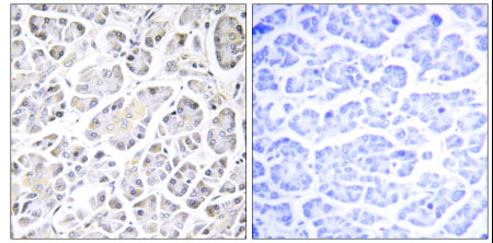 Immunohistochemistry (Formalin/PFA-fixed paraffin-embedded sections) - Anti-ATP5G3 antibody (AB129742)