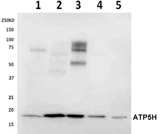 Western blot - Anti-ATP5H antibody [10G5AB2] (AB173006)