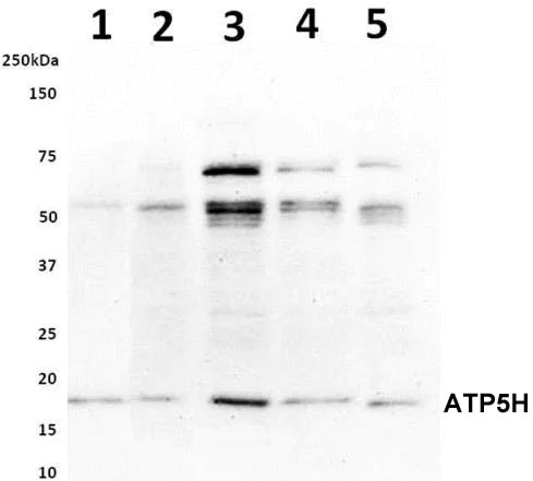 Western blot - Anti-ATP5H antibody [10G5AB2] (AB173006)