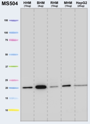 Western blot - Anti-ATP5H antibody [7F9BG1] (AB110275), expandable thumbnail